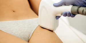 1 de 1 Depilação a laser em região íntima - Metrópoles - Foto: Freepik