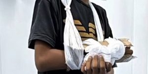 Menino de São Pedro de Aldeia sai de UPA com tala de papelão