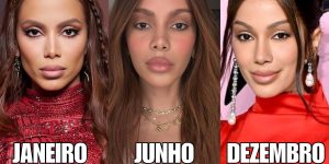 Anitta explica sua motivação para novas plásticas em 2025