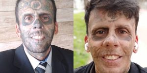 Leandro-de-Souza-comecou-o-processo-de-remocao-de-tatuagens