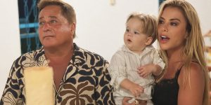 Leonardo realiza cirurgia estética e esposa revela resultado