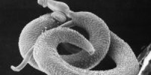 Schistosoma_mansoni2-e1774956063941