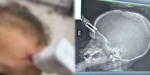 Reprodução / CearáAgora