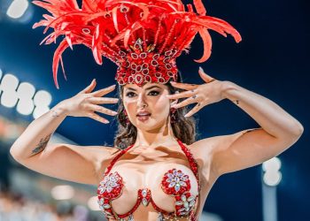 Miss Bumbum enfrenta queimadura durante preparação para Carnaval 2026