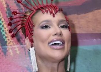 Virgínia Fonseca realiza tratamento inovador para cicatrizes de acne