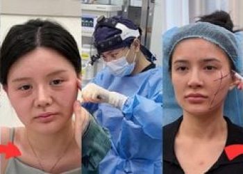 Samantha Schmütz impressiona com novo visual após procedimento estético