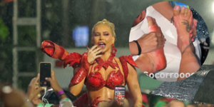 Procedimentos estéticos para garantir a pele perfeita no Carnaval