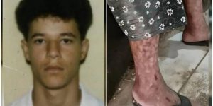 Filho é detido por manter mãe idosa em condições desumanas