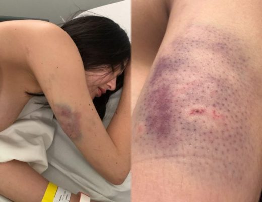 Polyanna Pilar mostra as agressões que sofreu do representante da BTG (Arquivo Pessoal